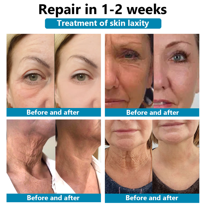 Luxurious Repair & Firming Serum | 🔥Last Day Discount: 80% OFF🔥