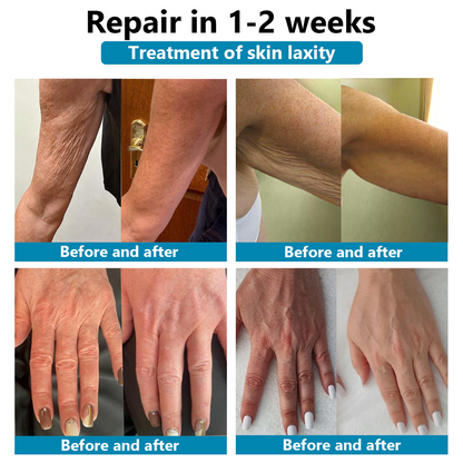 Luxurious Repair & Firming Serum | 🔥Last Day Discount: 80% OFF🔥