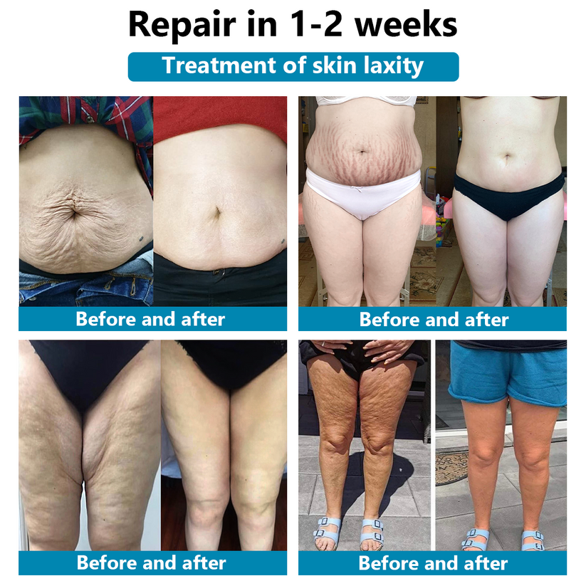 Luxurious Repair & Firming Serum | 🔥Last Day Discount: 80% OFF🔥