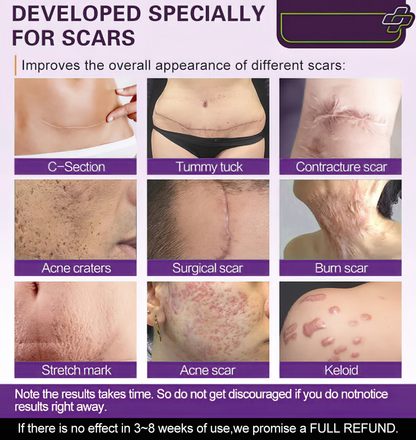 【Limited time discount sale🔥】 Advanced Scar Gel-🏆 Specialized for keloid management🏆
